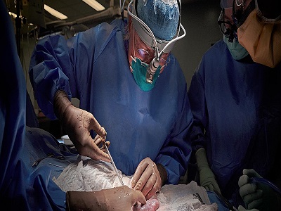 Xenotransplantation - The Future of Organ Transplantation - TechSci Research